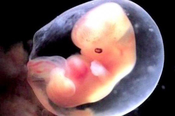 Résultat de recherche d'images pour "avortement"