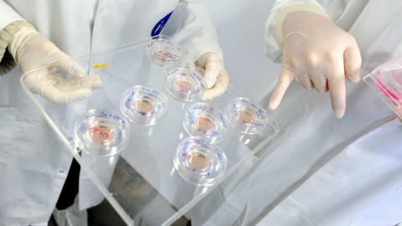 Modification génétique embryon mise garde spécialiste cellules souches adultes