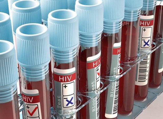 Californie contamination délibérée partenaire virus HIV