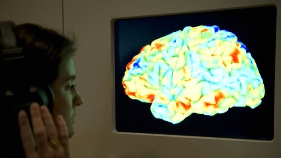 Diagnostiquer maladie Alzheimer sept ans avance