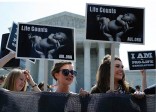 La loi anti-avortement du Texas retoquée par la Cour suprême