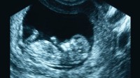 Etats-Unis militante pro-choix avortements pas assez nombreux