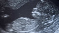 Planning familial Etats-Unis vente organes foetus minimiser scandale