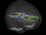 Une étude révèle le lien qui existe entre les connexions du cerveau et les comportements cognitifs