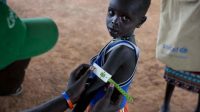 Au Soudan du Sud, un humanitaire mesure le bras de ce jeune garçon afin de savoir s'il souffre de malnutrition.