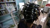 intelligence artificielle détecter Alzheimer 10 ans avant premiers symptômes