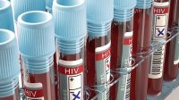 La Californie requalifie à la baisse la contamination délibérée d’un partenaire par le virus HIV