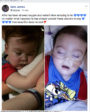 Alfie, pire que les nazis Alfie-Evans-debranche-respire-seul-90x112