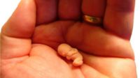 Mythes de l’avortement : au classement international de la protection de la vie, la Pologne est 127e et la France 164e