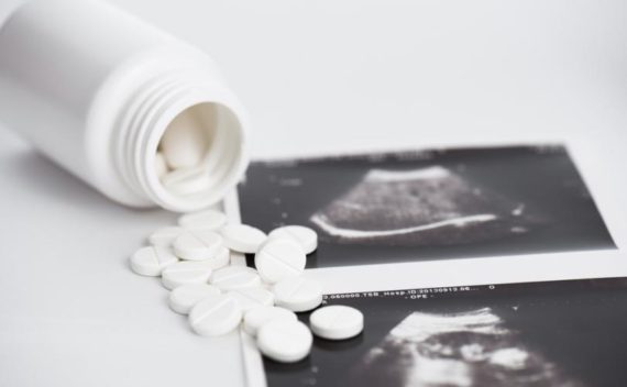 complications avortements chimiques doublées IVG domicile