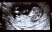 Le parlement européen fragilise le statut de l’embryon
