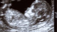 Wisconsin Planned Parenthood avortements