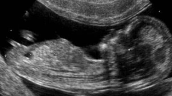 militants pro-vie arrêtés Memphis