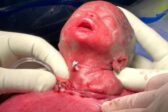 La photo : un bébé opéré dans le ventre de sa mère